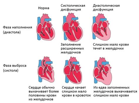 Основные признаки расстройства сердечной деятельности у младенцев