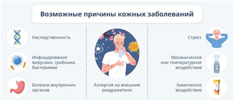 Основные причины возникновения заболевания