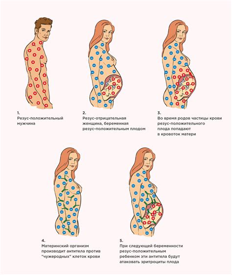 Основные типы резус-конфликта и их особенности