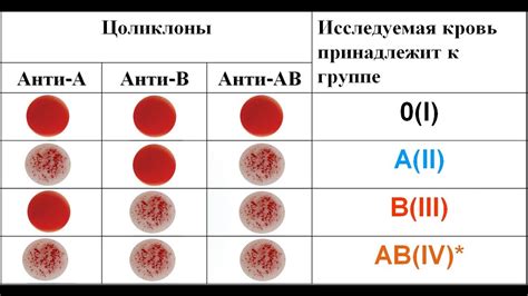 Особенности положительного и отрицательного резус-фактора крови