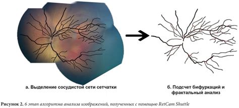 Особенности полученных изображений с помощью рентгенского сканера