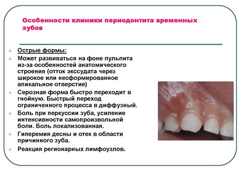 Особенности строения десен у детей различного возраста