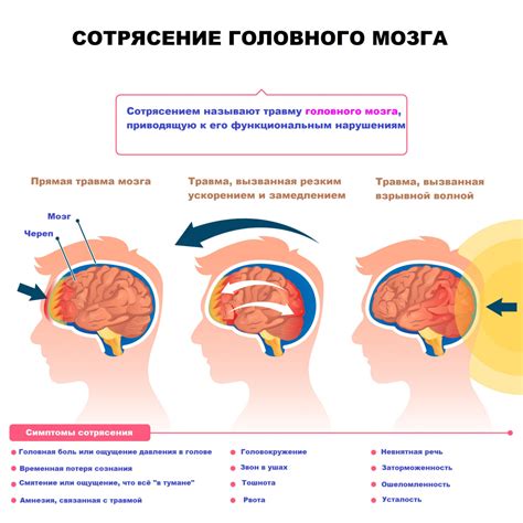 Отклонения в функционировании зрения по истечении сотрясения головного мозга у взрослых