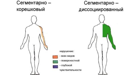 Отменные нарушения чувствительности