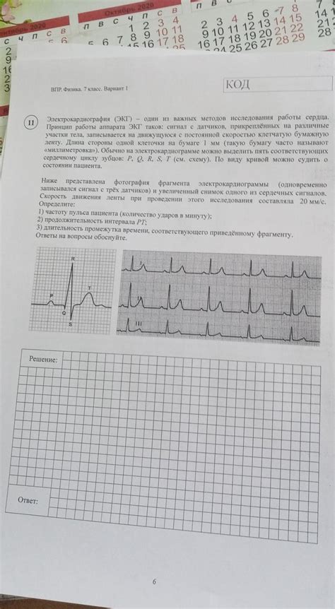 Патологические состояния, вызывающие увеличение промежутка PQ на электрокардиограмме