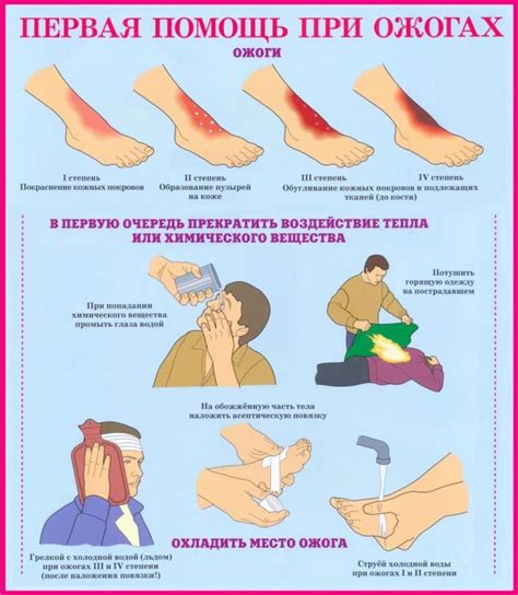 Первая помощь при ожоге горячей водой: основные меры
