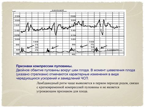 Перспективы развития кардиотокографии