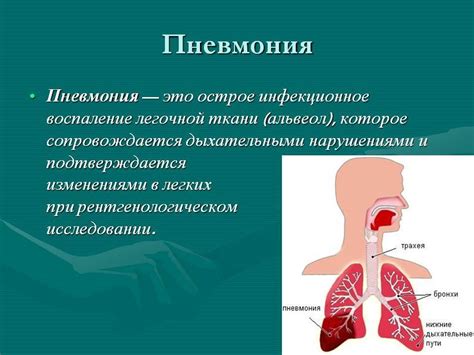 Пневмония и ее осложнения