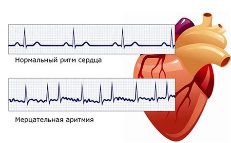 Пониженный ритм сердца: что это означает?