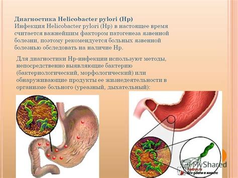 Последствия и осложнения после проведения процедуры обследования на наличие Helicobacter pylori