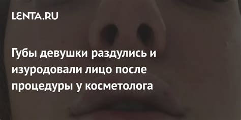 После процедуры: забота о спрятанных когтях и поощрение маленького праздника