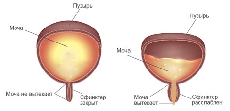 Почему возникают осадки в мочевой системе у детей?