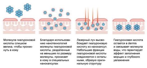 Правила применения гиалуроновой кислоты в эстетических процедурах