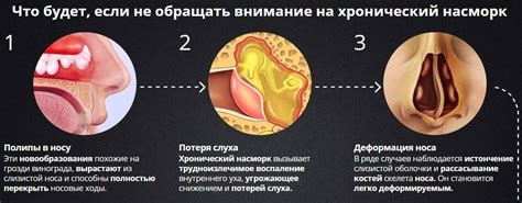 Прежде чем начать лечение гноя на слизистой носа