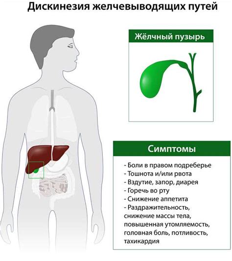 Признаки и диагностика нарушения оттока желчи