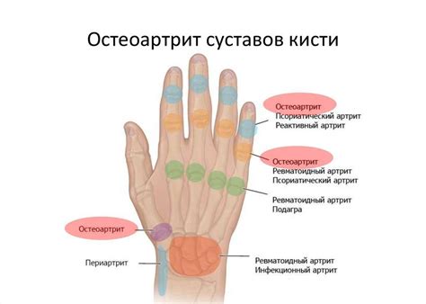 Примета №4: Ощущение ломоты и онемения в левой руке после сильного воздействия на локоть