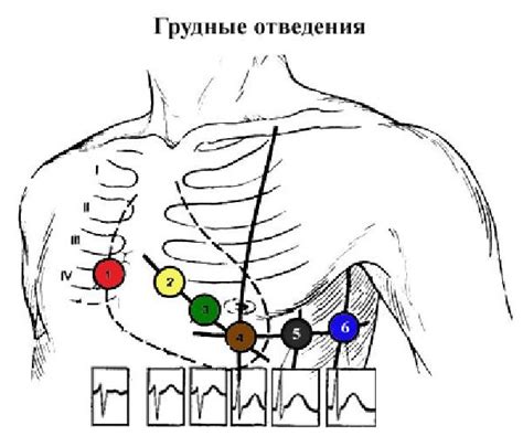 Принцип работы ЭКГ и ее сущность