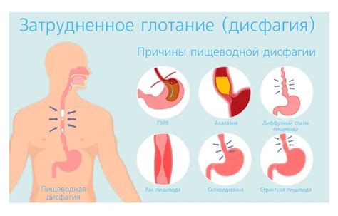 Причины, почему возникает проблема глотания слюны