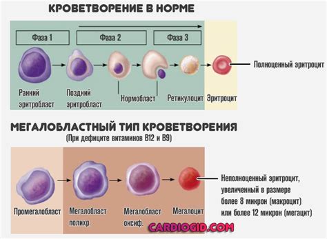 Причины и симптомы микроцитоза: важная информация для здоровья