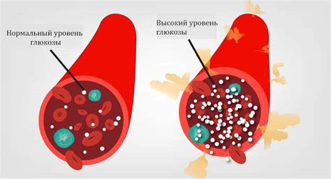 Причины резких флуктуаций глюкозы в крови у представительниц прекрасного пола