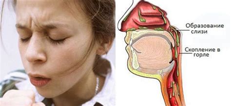 Проблема образования и зачистки слизи в носоглотке: причины и способы устранения