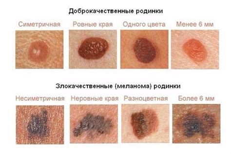 Профилактика образования дефектов на коже лица