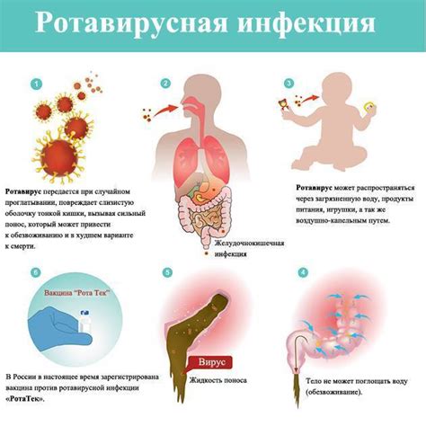 Профилактика ротовирусной инфекции у взрослых