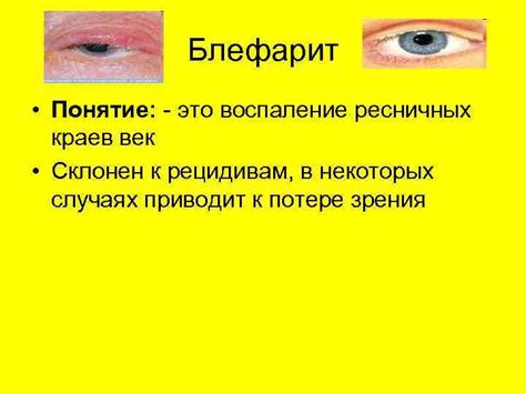 Раздел: Сохраните здоровье ресничных краев для предотвращения их выпадения