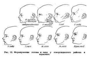 Рекомендации для родителей при наклоне головы влево у новорожденных