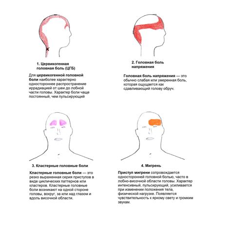 Рекомендуемые методы лечения головной боли