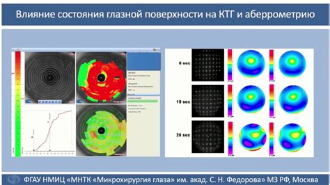 Рефракционные ошибки