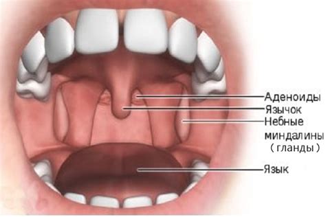 Роль гланд и аденоидов в защите организма от инфекций