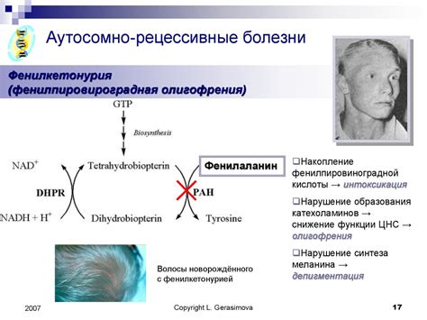 Роль наследственности в формировании прогрессивных изменений в спине