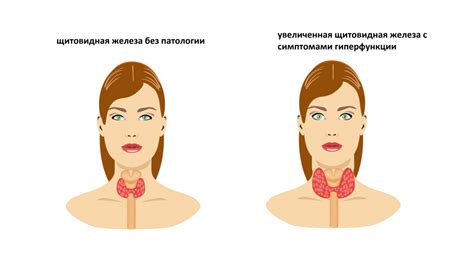 Связь между неработоспособностью гормона ТТГ и расстройствами щитовидной железы у женщин