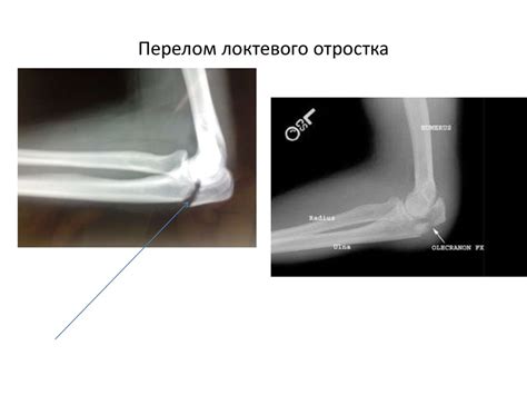 Связь с заболеваниями и необычными событиями при получении удара по левой части локтя