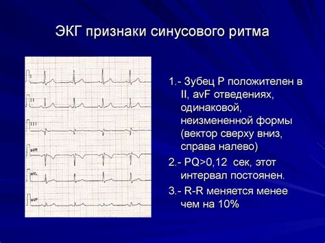 Связь S-инверсии на ЭКГ с состоянием сердца