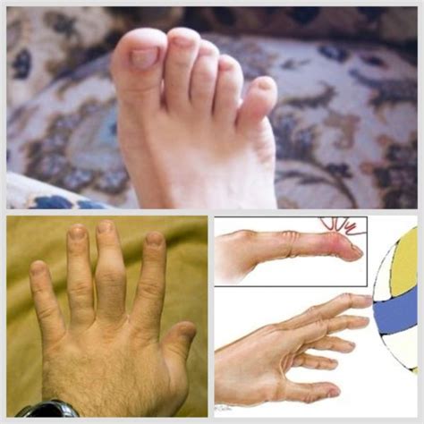 Симптомы и диагностика образования на руке