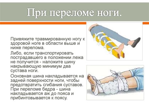 Симптомы и первая помощь при переломе конечности