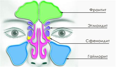 Синусит: основные причины