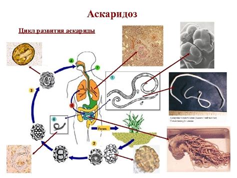 Системные проявления аскаридоза и связь с поражением органов