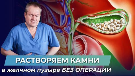 Соблюдение режима питания и контроль за весом для предотвращения образования камней в желчном пузыре