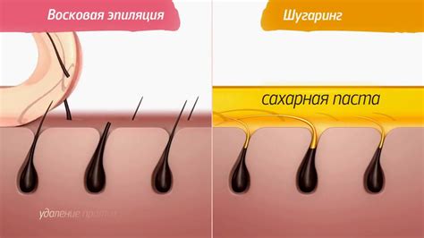 Сравнение методов удаления волос: воск и сахарная паста