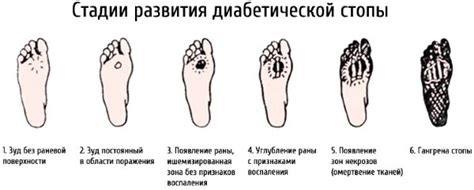 Стадии развития гниения порогов и способы их отремонтировать