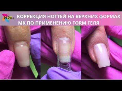 С использованием содового раствора - нежный подход к очистке ногтей от адгезива