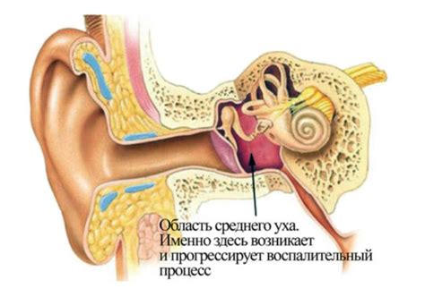 Типы воспаления среднего уха и их особенности