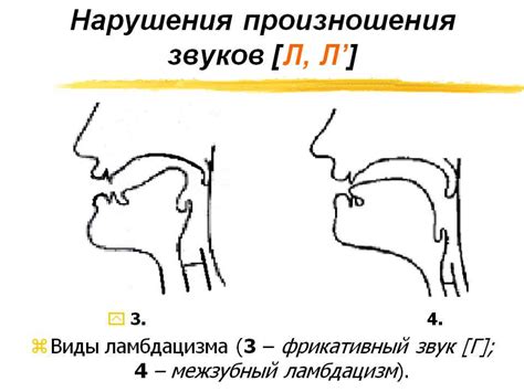 Упражнения для развития моторики произношения звука "л"