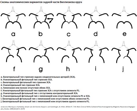 Физиологическое развитие Виллизиевого круга