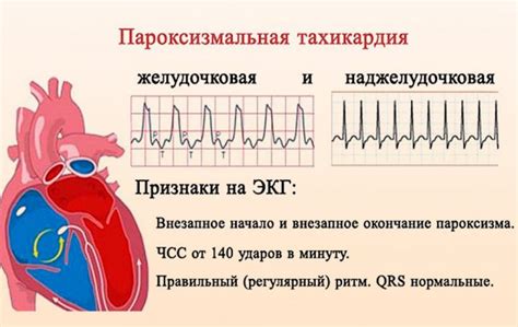 Функция аномального электрокардиографического сигнала в области наджелудочкового выступа у маленького пациента