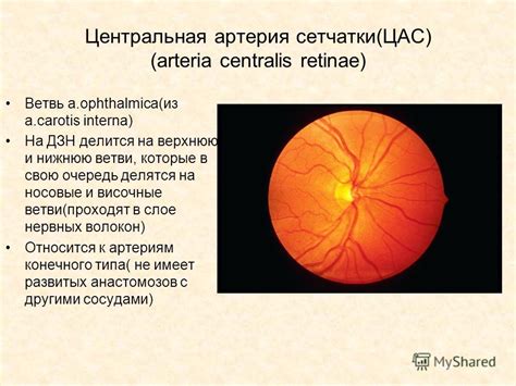 Центральная артерия сетчатки