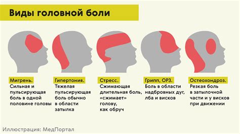 Что вызывает головную боль в левой части затылка?